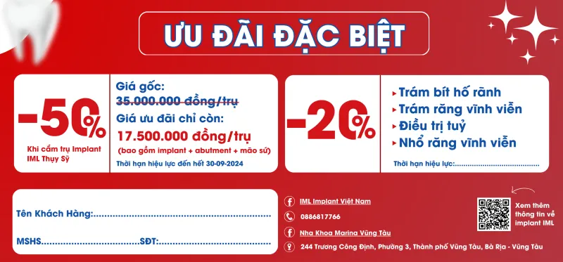 Voucher dịch vụ tại Nha Khoa Marina