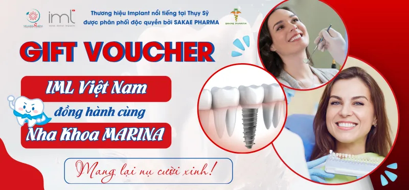 Voucher giảm 50% trồng răng implant tại Nha Khoa Marina