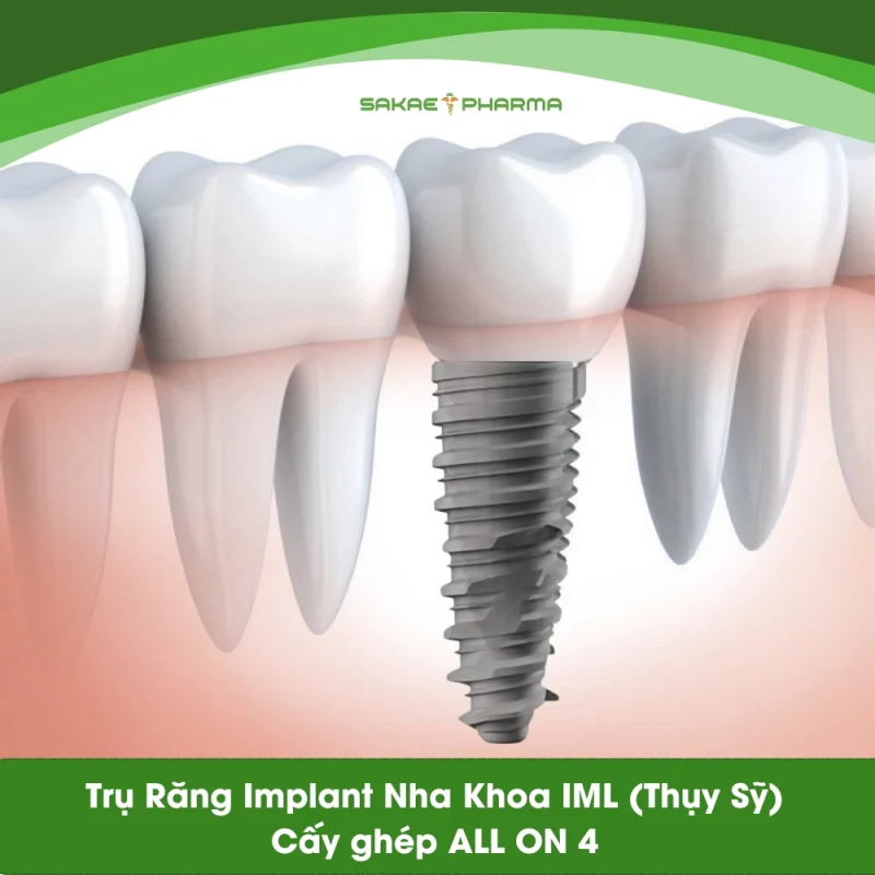 Trụ răng implant IML