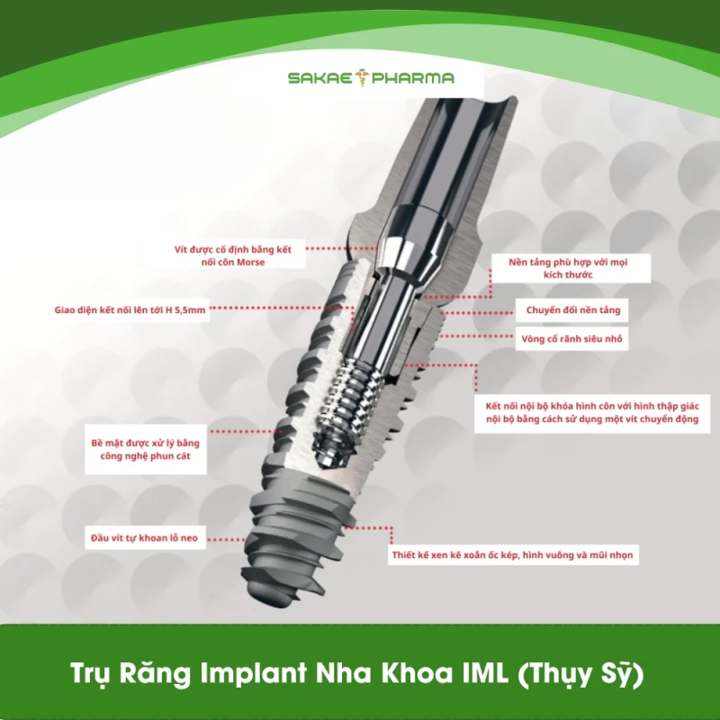 Ưu điểm của trụ implant nha khoa IML Thụy Sỹ