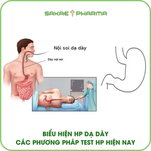 Các phương pháp test hp dạ dày hiện nay