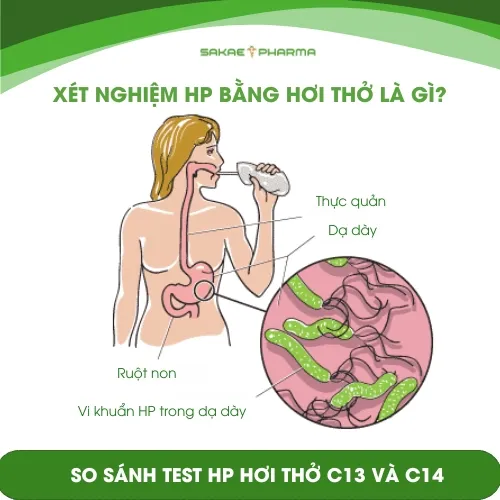 So sánh test hp hơi thở C13 và C14 | Xét nghiệm hp bằng hơi thở