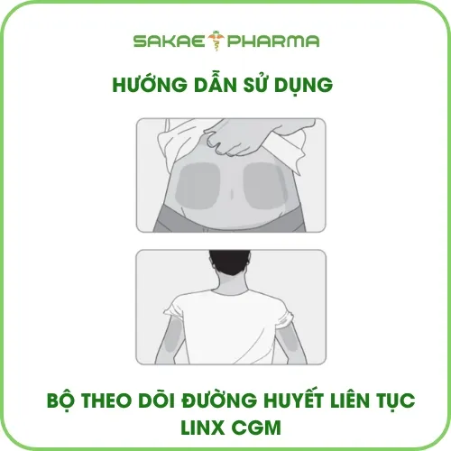 Vị trí gắn cảm biến