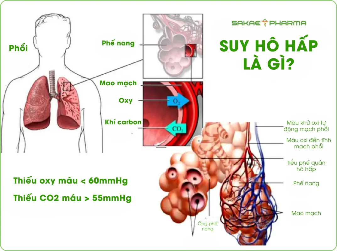 Ảnh minh họa suy hô hấp là gì?