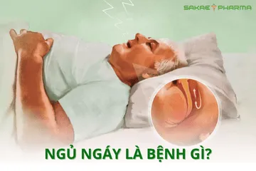 Ngủ ngáy là bệnh gì? Nguyên nhân, dấu hiệu và cách điều trị hiệu quả