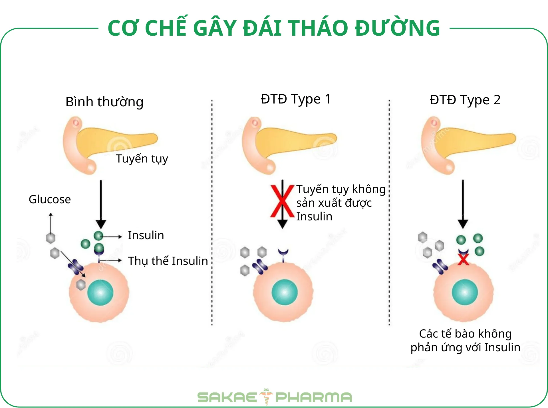 Bệnh tiểu đường có lây không