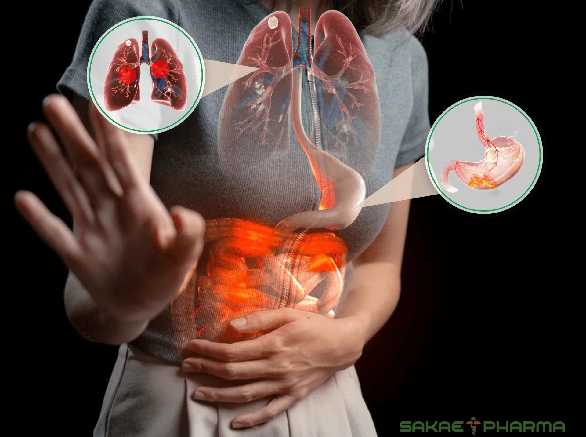 Mối nguy khi trào ngược dạ dày