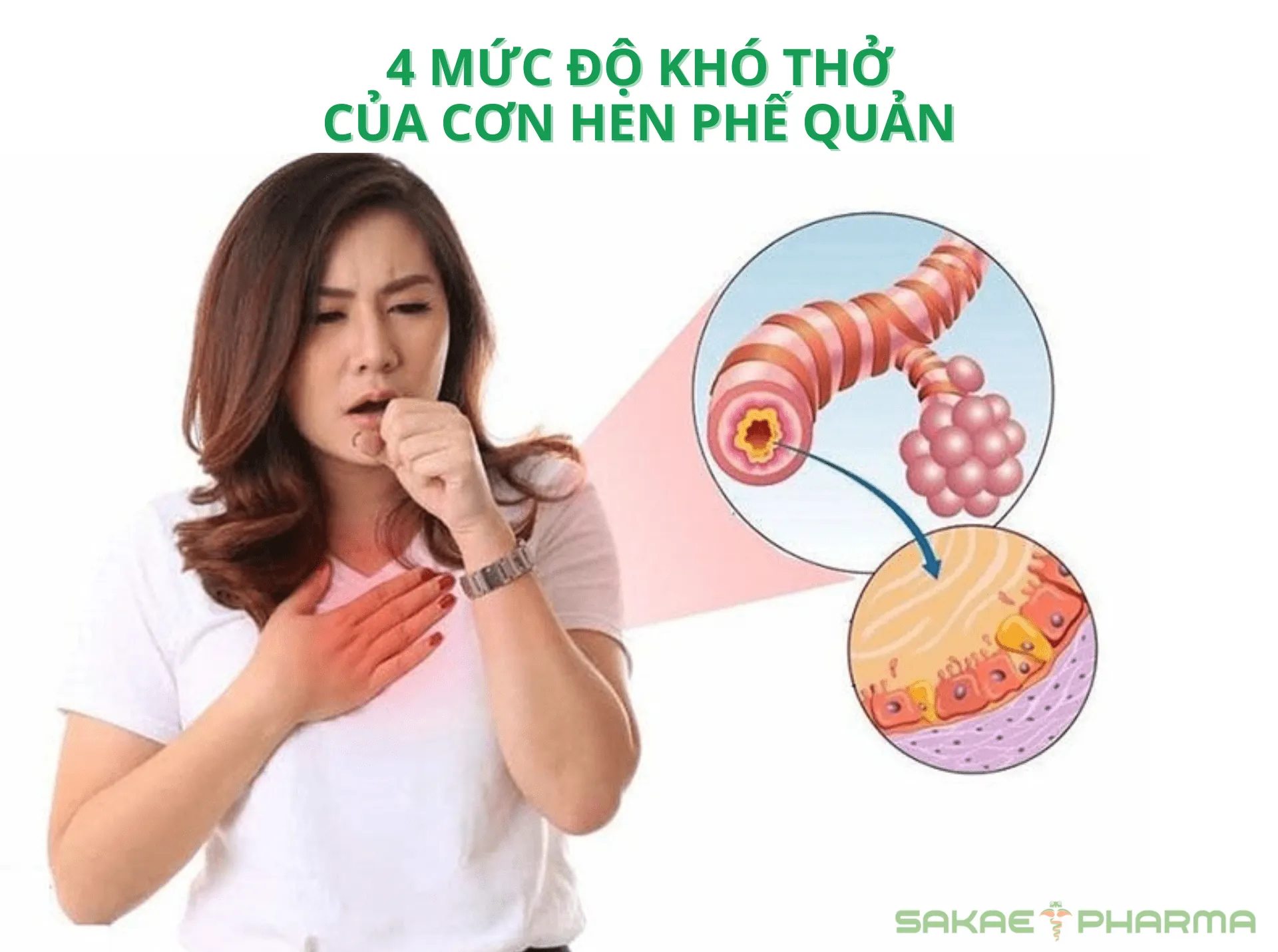 4 mức độ khó thở của cơn hen phế quản