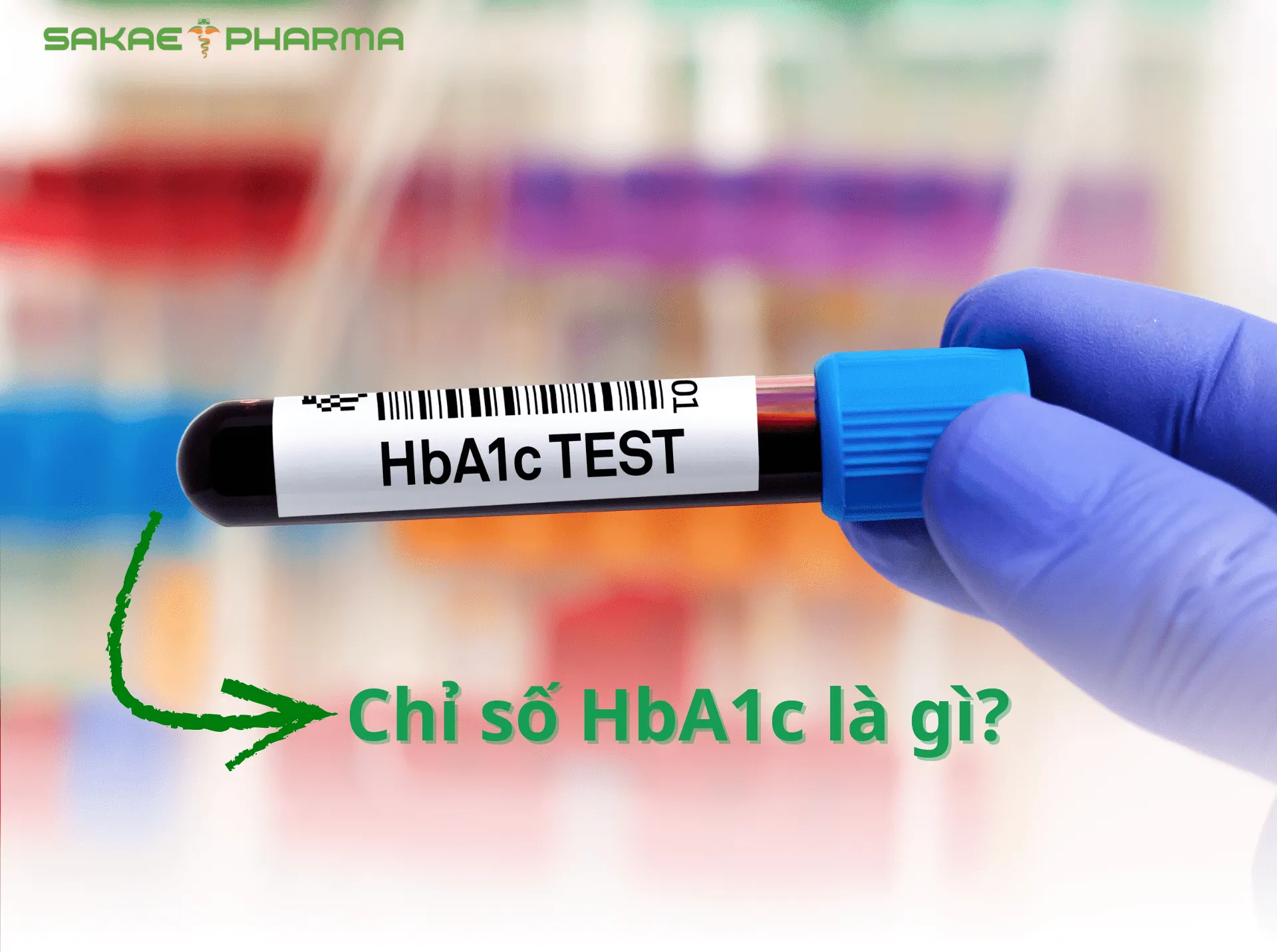 Chỉ số HbA1c bao nhiêu là tiểu đường
