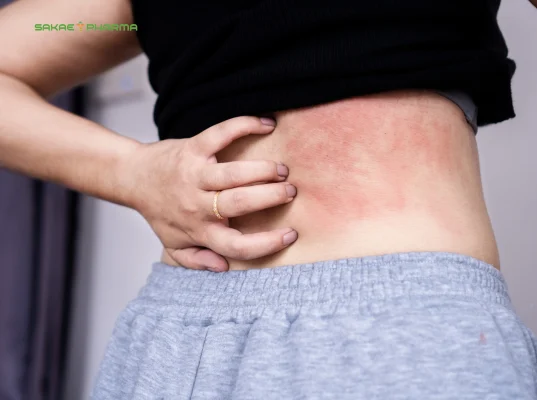 biến chứng tiểu đường ở da