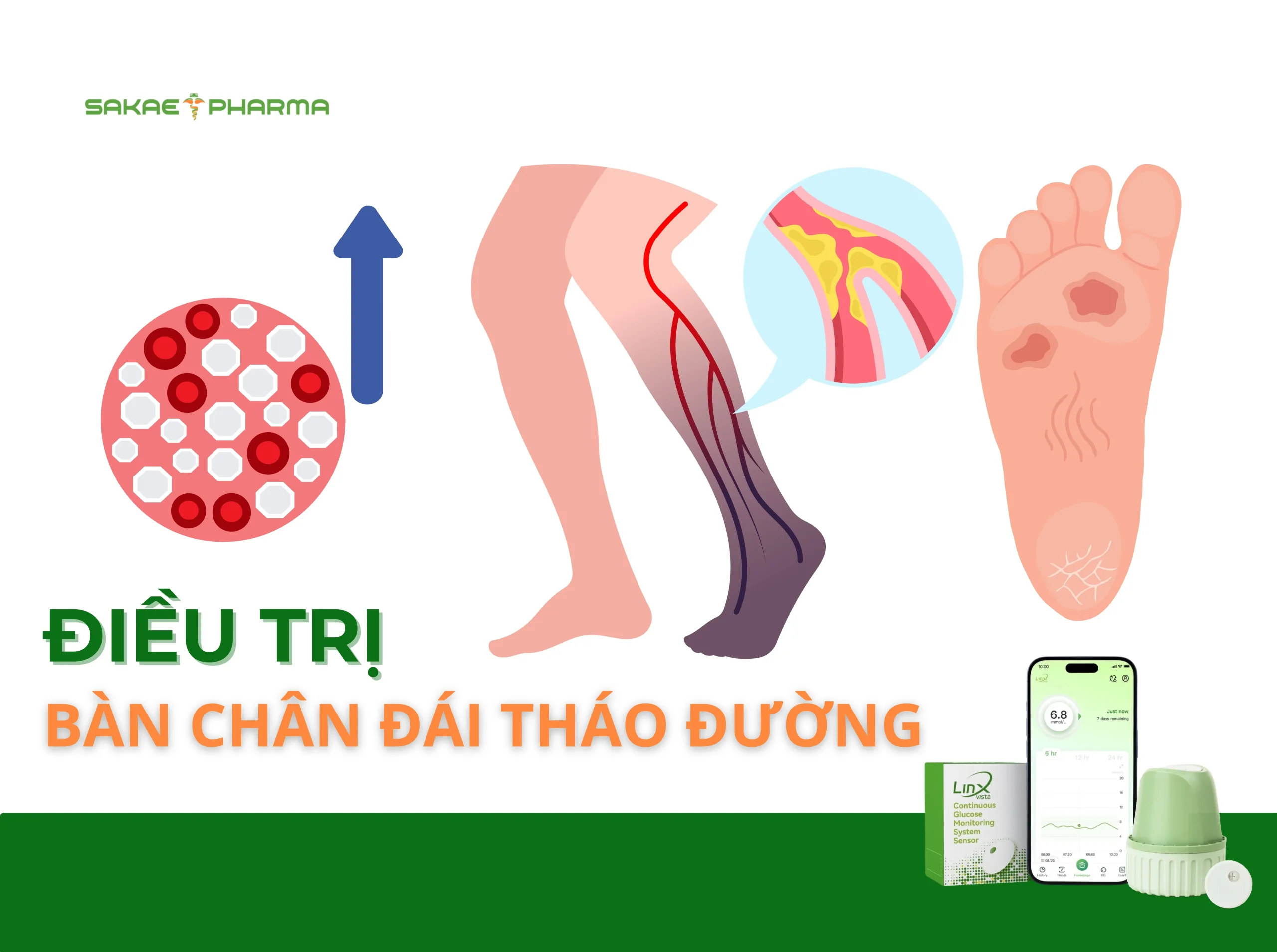 bàn chân đái tháo đường