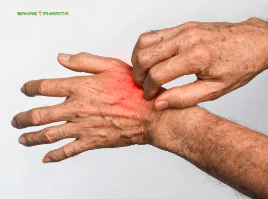 biến chứng tiểu đường ở da