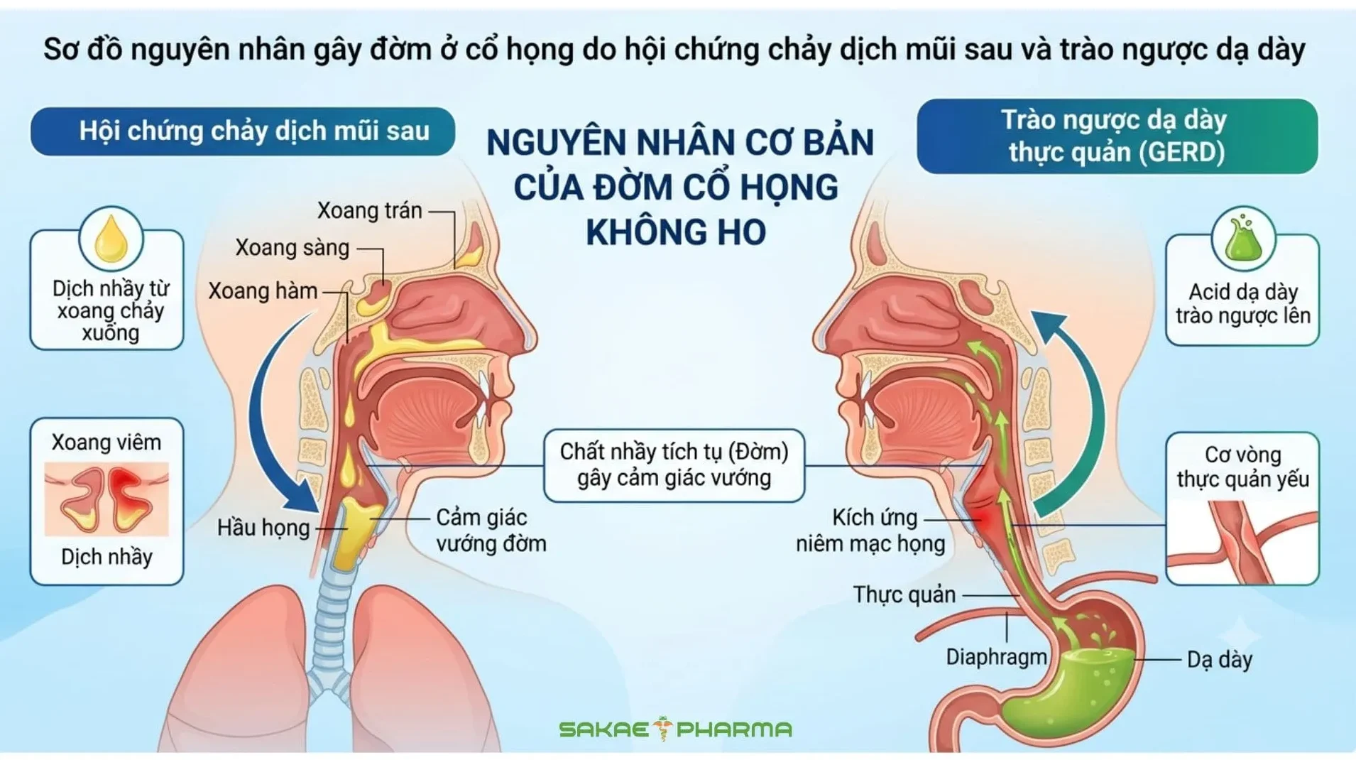 Không ho nhưng có đờm ở cổ họng