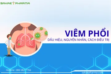 Viêm phổi: Dấu hiệu, nguyên nhân và cách điều trị hiệu quả