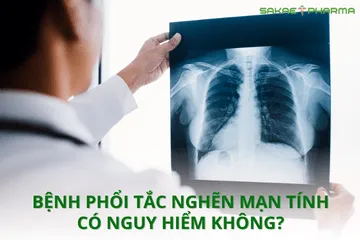 Bệnh phổi tắc nghẽn mãn tính có nguy hiểm không? Biến chứng và cách phòng ngừa hiệu quả
