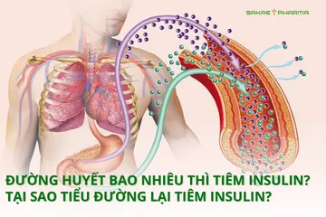 Đường huyết bao nhiêu thì tiêm insulin