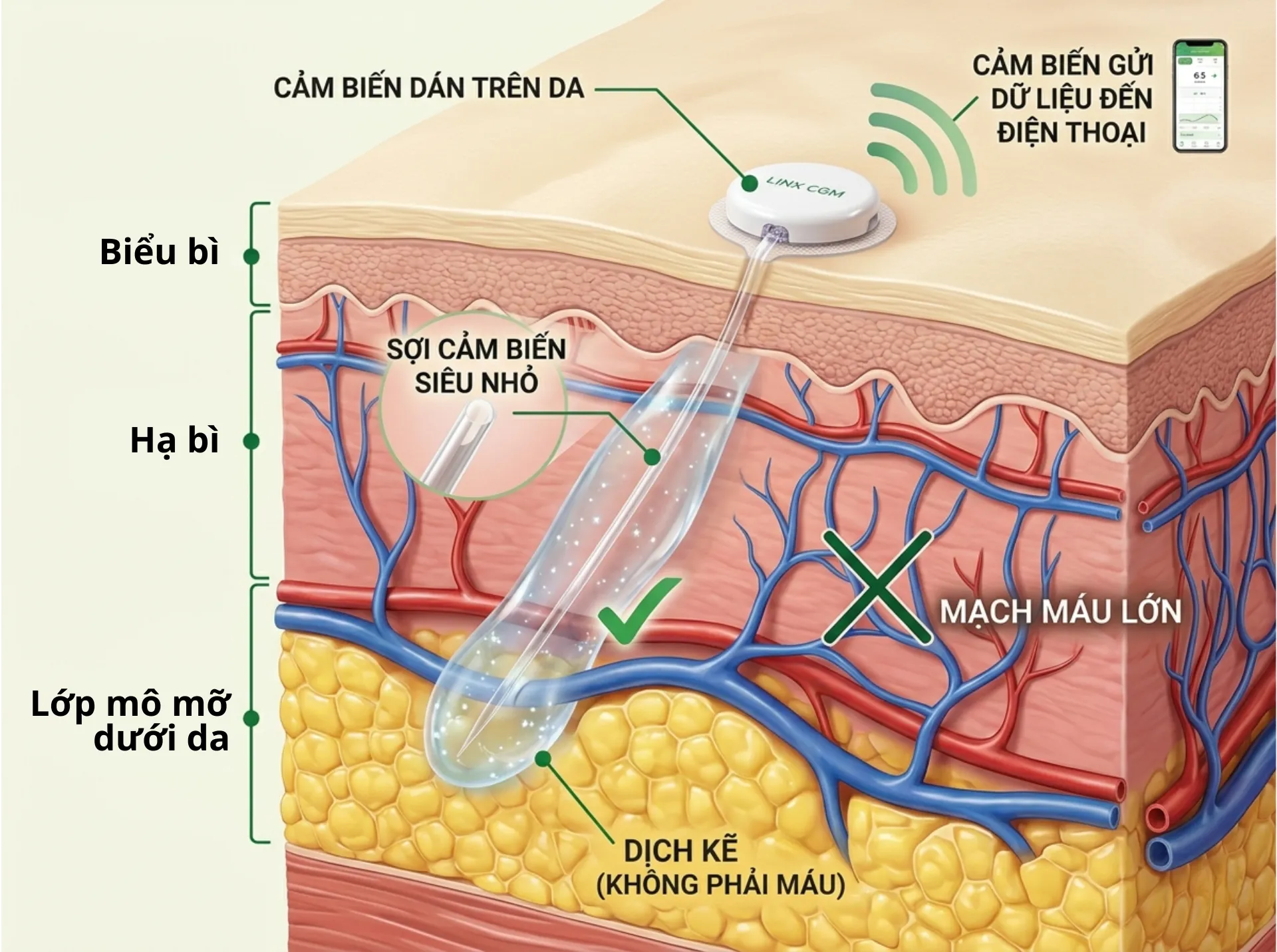 Máy đo đường huyết không cần lấy máu