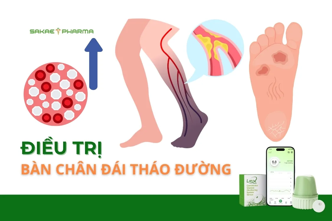 Điều trị bàn chân đái tháo đường và hướng dẫn chăm sóc biến chứng tiểu đường loét bàn chân