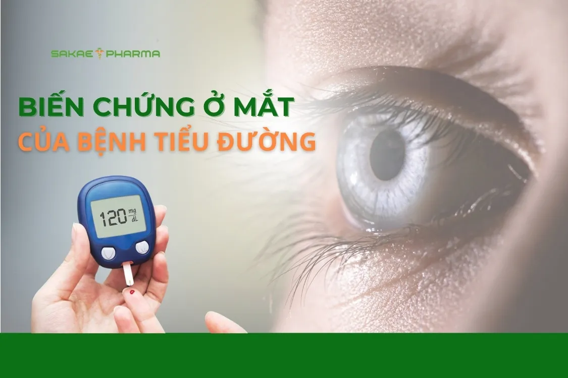 Biến chứng tiểu đường ở mắt: Dấu hiệu cảnh báo nguy cơ mất thị lực cần biết