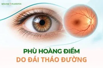 phù hoàng điểm do đái tháo đường